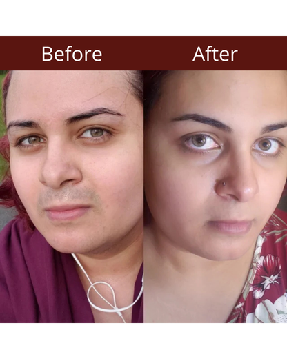 Rosalisse Cyperus Rotundus Oil