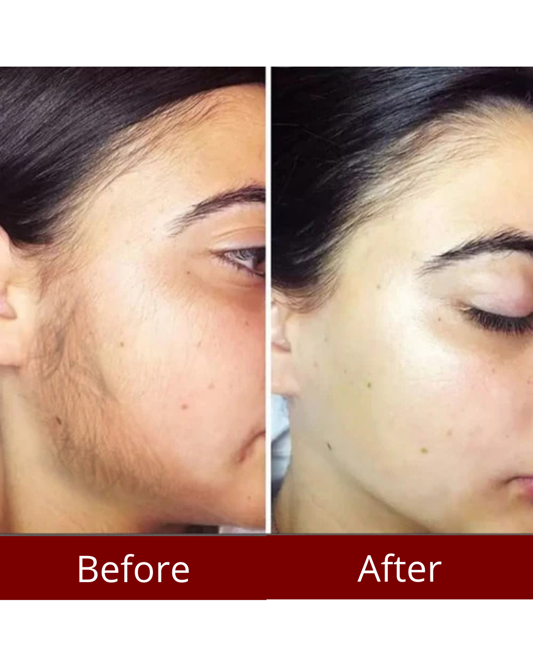 Rosalisse Cyperus Rotundus Oil