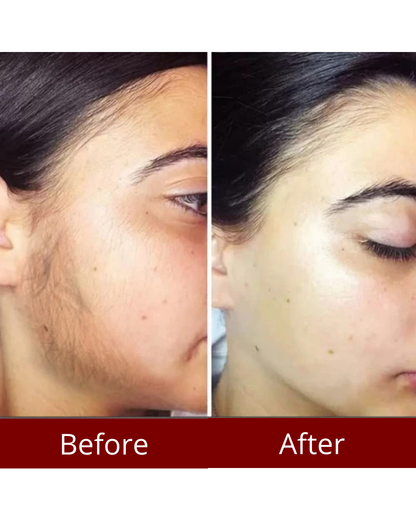 Rosalisse Cyperus Rotundus Oil